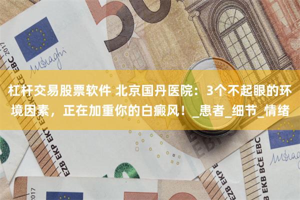 杠杆交易股票软件 北京国丹医院：3个不起眼的环境因素，正在加重你的白癜风！_患者_细节_情绪